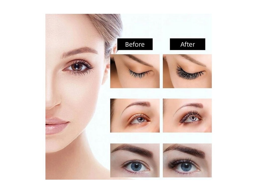 skvelá kulma na mihalnice